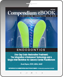 One-Day Endo-Restorative Treatment: The Integration of Advanced Technology and a Single-Visit Workflow for General Dental Practitioners Ebook Cover