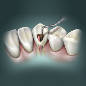 Endodontics Ebook Library Image