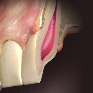 Updates in Endodontics Ebook Library Image