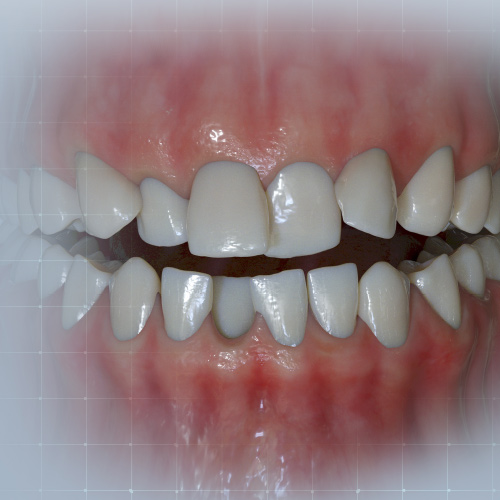 Today's Trends in Orthodontics Ebook Library Image