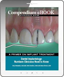 Dental Implantology: Numbers Clinicians Need to Know Ebook Cover