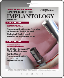 Spotlight on Implantology Ebook Cover