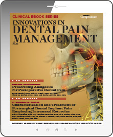 Innovations in Dental Pain Management Ebook Cover