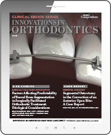 Innovations in Orthodontics Ebook Cover
