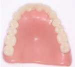 Fig 33. The 3D printed denture bases and teeth assembled for the maxillary and mandibular digital dentures.