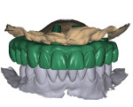 Fig 7. The alignment of the three scans providing all necessary information, including tooth position, relative implant positions, soft-tissue intaglio, and occlusion, for the laboratory to design and fabricate a prototype prosthesis.