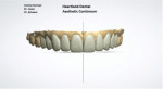 Fig 3. A smile design was submitted to the clinician for his review and approval.
