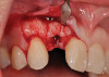 (3.) Preoperative full face view.