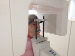 Figure 3 Patient positioned in CBCT machine, with the full-arch VPS impression seated on maxillary arch.