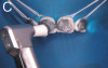Figure 3 Tooth preparations were completed for full-coverage monolithic ceramic restorations.