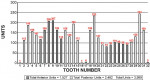 Figure 11  Distribution of units by tooth number.
