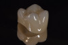 Fig 14. Discoloration masked with layered 3Y zirconia crowns.