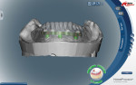 Figure 5 The approved denture wax-up was scanned and superimposed over the bar design to prior for approval prior to bar milling.