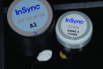 Fig 5. InSync Zr Layering Ceramic is used as the bonding layer.