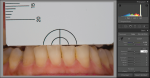 Fig 9. The Digital Color Meter software records the L*a*b* values of the cervical areas of tooth No. 24.