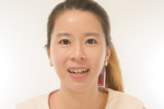Fig 18. Full-face view after completion of clear aligner treatment.