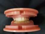 Fig 6. Maxillary and mandibular BDLoads include an integrated tooth set-up.