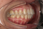 Fig 4. Pretreatment intraoral photographs.
