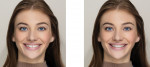Intraoral scanner applications can simulate the tooth movements of orthodontic treatment plans, allowing patients to view their pretreatment photographs alongside images of their potential outcomes.
